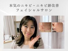 ルナティアラ(LUNAティアラ)