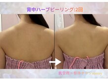 メリー 大和西大寺店(merry)/背中ハーブもブライダルなどに★