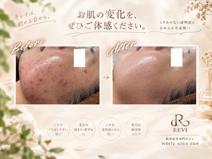 ホワイトアクア 浜松店(WHITE AQUA)の写真