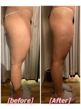 ココチ(KOKOCHI)/下半身痩せ