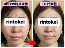 凛と慶/ビフォーアフター