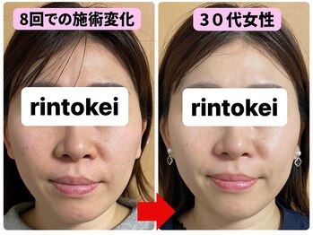 凛と慶/ビフォーアフター