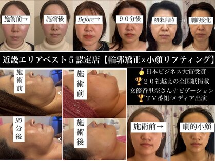 フェミニー(Feminy)の写真