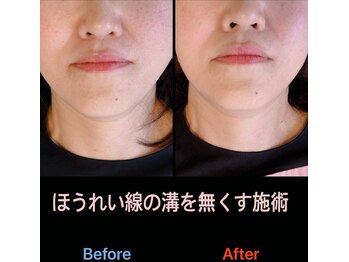 美容矯正サロン レレポノ(LELEPONO)/