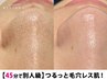 人気No.2★【皮脂の出やすい季節におすすめ】毛穴洗浄〈鼻のみ〉¥6,600