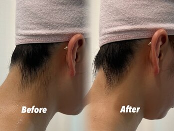 クイーン 渋谷店(QUEEN)/悩めるうなじ難民の方