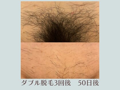 ハル(Haru)の写真