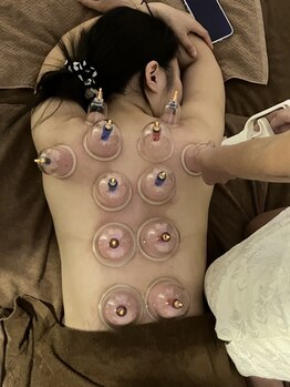 体と心の恵み/レディース　カッピング