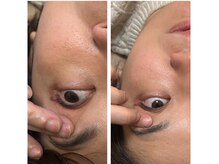 シゼン(Shizen)/眼精疲労ケアも人気です！