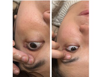 シゼン(Shizen)/眼精疲労ケアも人気です！