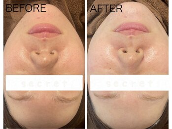 ホープリテーラー 安城店(HOPE Retailer)/施術写真