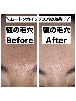 ポワールムース(POIRE mousse)/Before&After写真☆