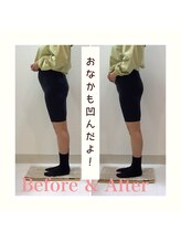 スタイルラボ高松/産後の骨盤矯正の効果♪