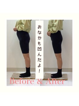 スタイルラボ高松/産後の骨盤矯正の効果♪