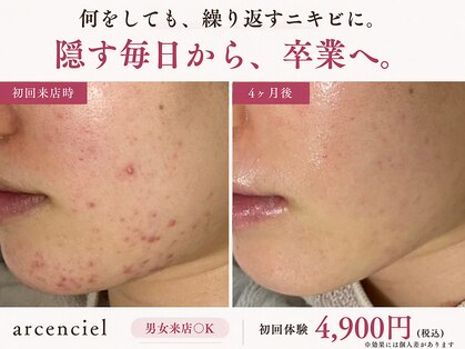アルカンシエル(arcenciel)の写真