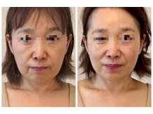 メディカルエース(MedicalAce)/若々しい印象へ！ならハイサーマ