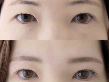 シャール(shall)/まつ毛パーマ/まつげ/マツパ