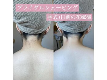 リンド エステ まつげ 京成大久保(Lind)/ブライダルシェービング