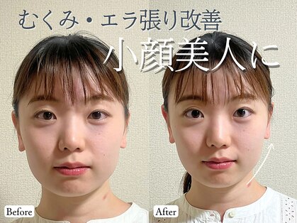 リン 吉祥寺店(Rin)の写真