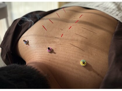 ツナギ美容鍼灸 整体院 宇都宮院(TSUNAGI美容鍼灸 整体院)の写真