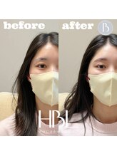 トゥルヌソル 宇都宮(tournesol)/ハリウッドブロウリフト