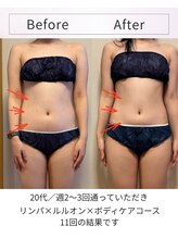 ヨサパーク ハーブ 温 東花園(YOSA PARK Herb 温)/11回でウエストラインに変化！