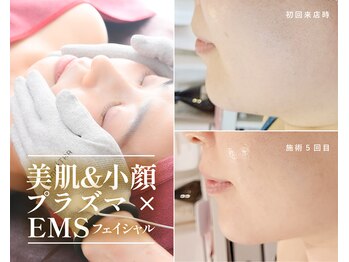 シュシュ(Chouchou)の写真/[近日導入]大注目のPLASMASTAR！プラズマハンド×EMSテラヘルツで、驚きの小顔と美肌を体験しませんか？