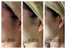 サロンドジェシカの雰囲気（【顔脱毛 】全体のムダ毛を取り除き整えます完全シェービング付）