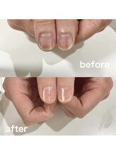 リーシュ 所沢店(RICHE)/爪育ネイルケア