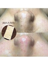 プライベートサロン コットン(COTTON)/毛穴エクストラクション
