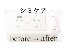 ブランシェ 富山店 × 椿/次世代シミケア機器　「REAGE」