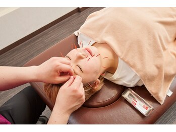 上本町鍼灸整骨院の写真/筋膜アプローチでフェイスラインをリフトアップ♪顔のむくみや肌荒れを改善◎《美容鍼￥7,700→￥3,850》