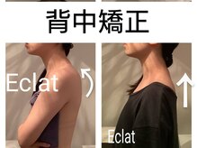 エクラ(Eclat)/背中矯正/姿勢改善/ダイエット