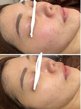 ジェニー(JENNI)/トロイピール　２回での変化