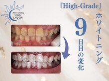 ラフ(LAUGH)/【審・美・白】 ホワイトニング