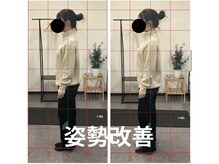 カワル整体 長嶺院/姿勢改善