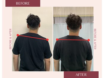 浦安駅前鍼灸整体院/ before&after