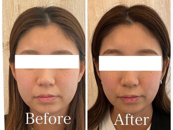 サロンベイビー 西宮本店(Salon Baby)/小顔美容整顔×上半身整体　60分