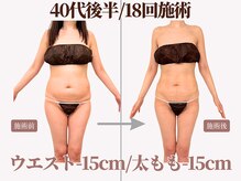 ベモーレ 谷町九丁目 上本町/40代後半/18回施術