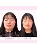 人気No.1【食いしばり・エラ張り・左右差改善】小顔整体 初回体験 ¥9,000⇒