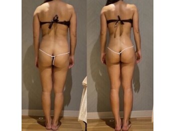 ソニョ(SONYO)の写真/夏までに変わりたいあなたへ。無理なく続く本気の痩身ケア◎