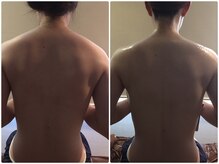 ケムズ インプルーブメントサロン(KMS IMPROVEMENT salon)の雰囲気（ガチガチ首肩集中ケア１回でここまでスッキリしました！）