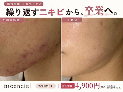 アルカンシエル(arcenciel)の写真