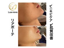 ルアノーヴァ(Lua-nova)の雰囲気（当店で絶大の人気を誇るリアボーテ♪安定の効果でリピート率No.1）