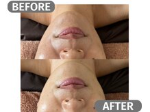 インフィニート 上野毛(infinito)/★BEFORE/AFTER★