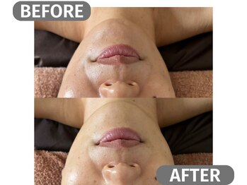 インフィニート 上野毛(infinito)/★BEFORE/AFTER★