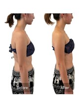 リセ(RESE)/温熱インディバとヘッドセラピー