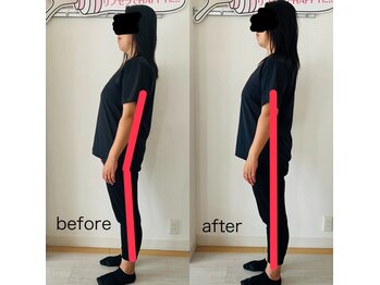 このか/脚から腰、背中の姿勢改善