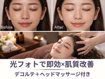 フルーブラン(Frubran)/フォトで一気に引き上げ肌質改善