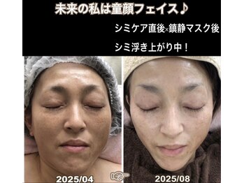 アルページュ(Arpege)/未来の今は色白美人♪